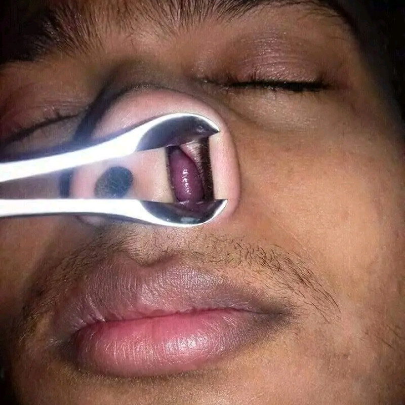 Polypus medicin for doctors