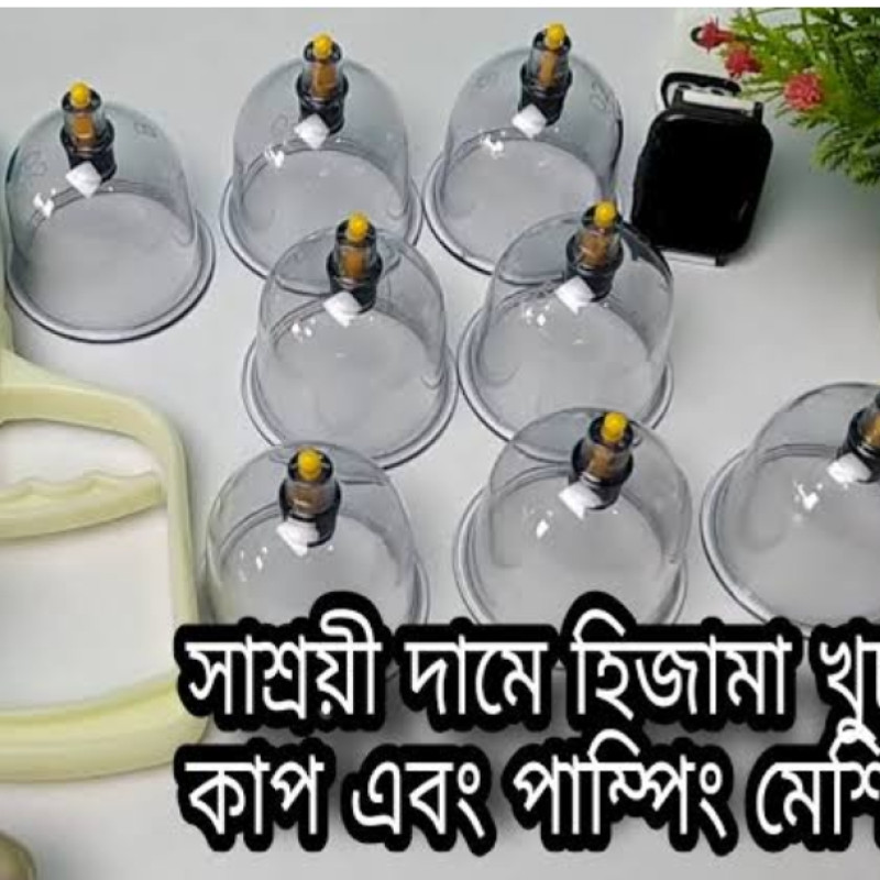 হিজামা থেরাপির কাপ