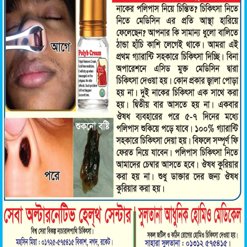 Polypus remove 7 day challenges