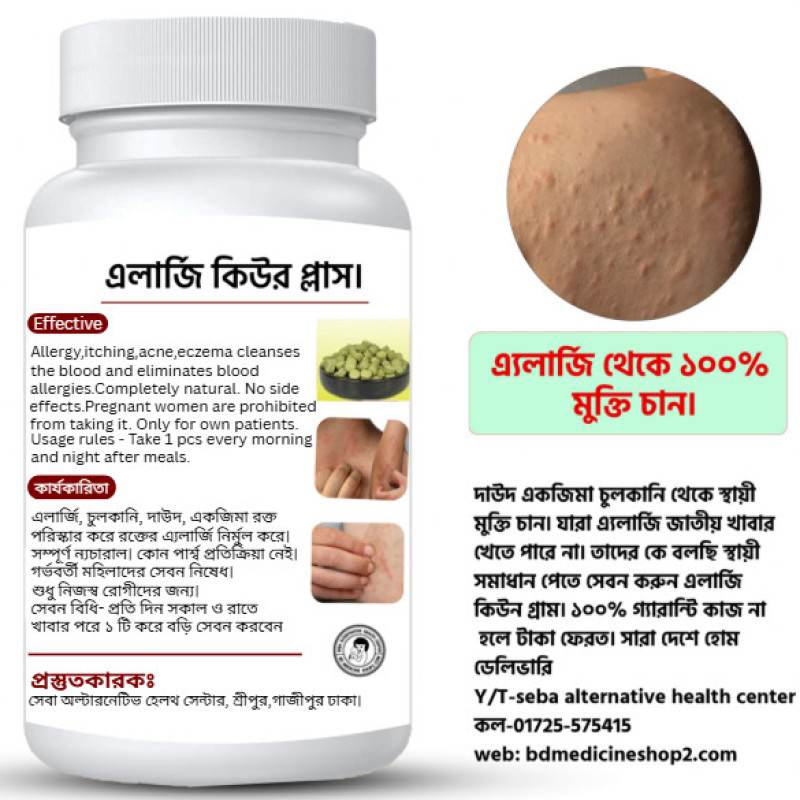 Allergi Eczema