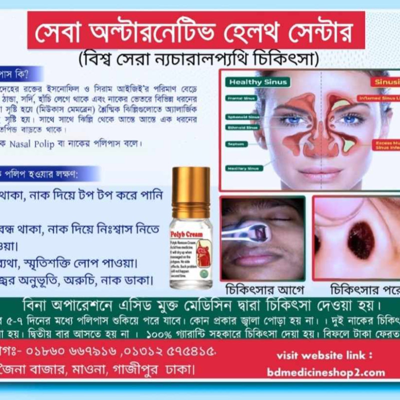 Polypus remove 7 day challenges