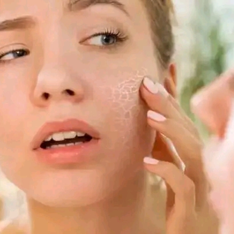 Skin care drop এলার্জি একজিমা চুলকানি।