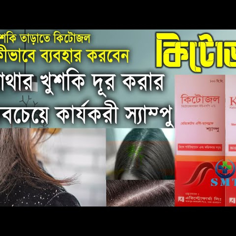 Ketozol shampoo খুসকি ও চুলকানি জন্য