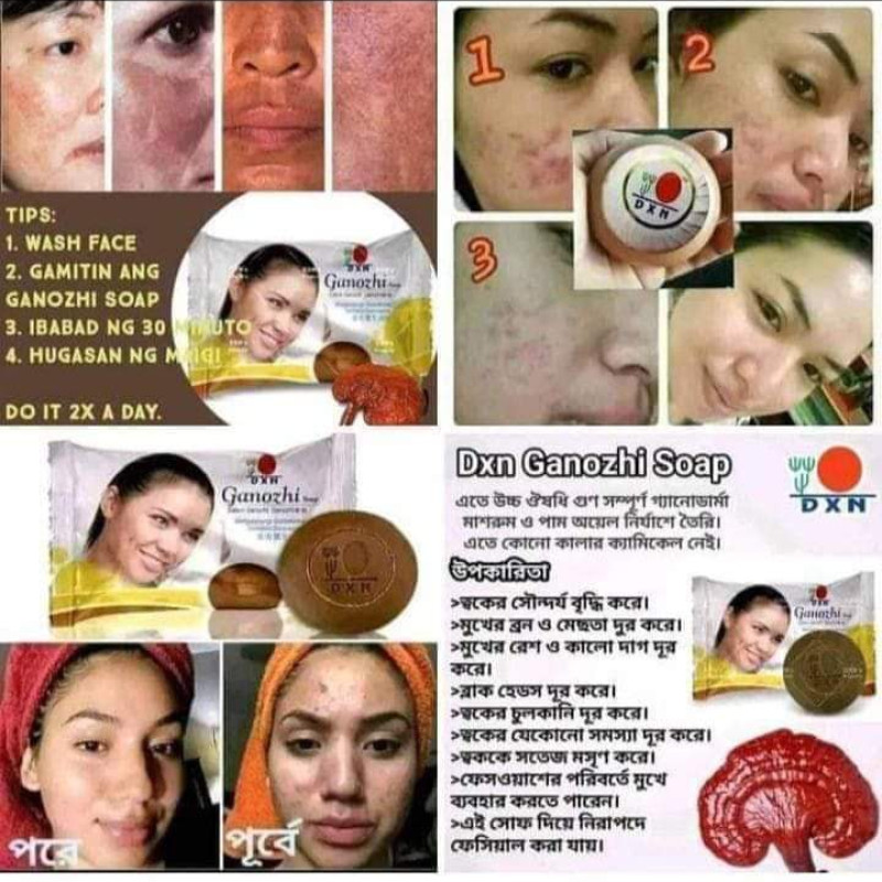 DXN Gonozhi soap ব্রণ, মেছতা দূর করে।